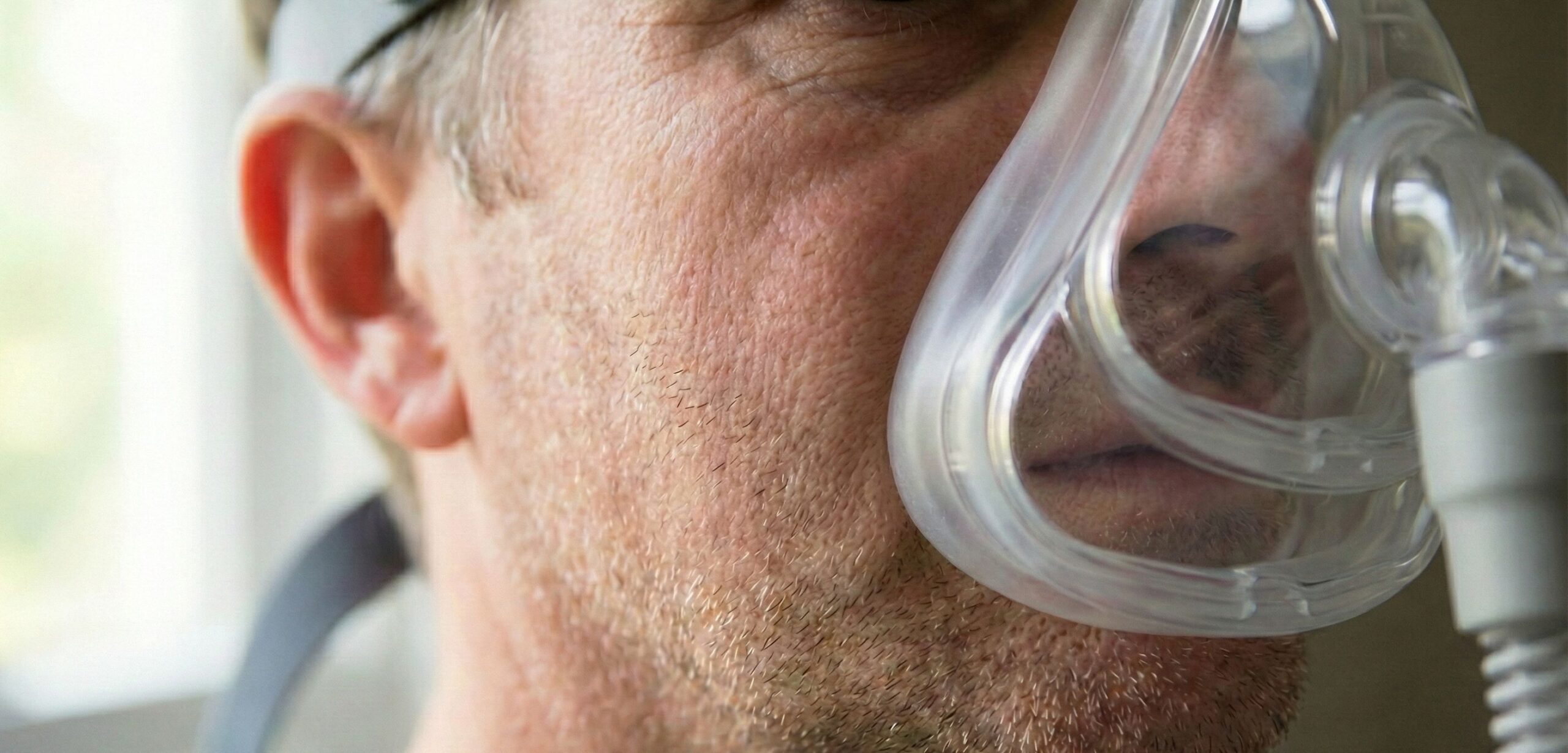 Diagram showing CPAP mask leaking weight loss issues due to buccal fat loss